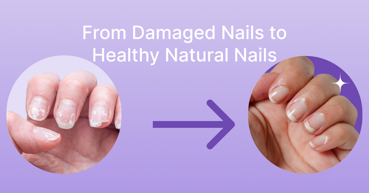 How to Cure Damaged Nails Naturally