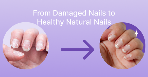 How to Cure Damaged Nails Naturally