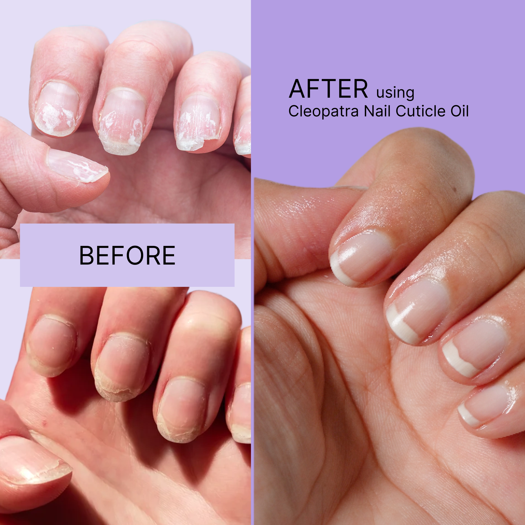 Cleopatra Nail Cuticle Oil twist pen before and after results